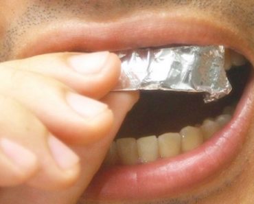 papel alumínio nos dentes
