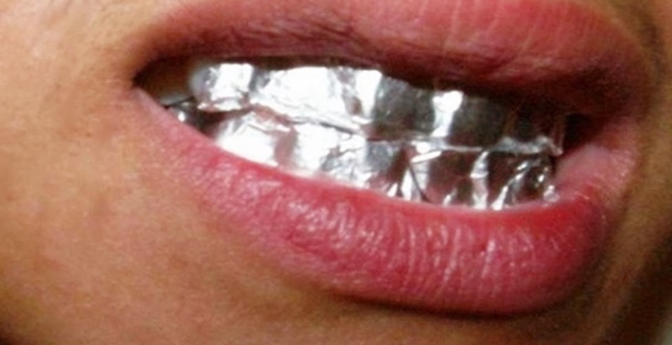 papel alumínio nos dentes