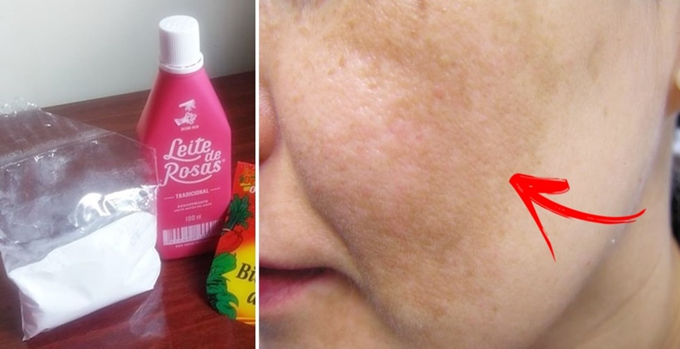 Tratamento para pele com leite de rosas e bicarbonato