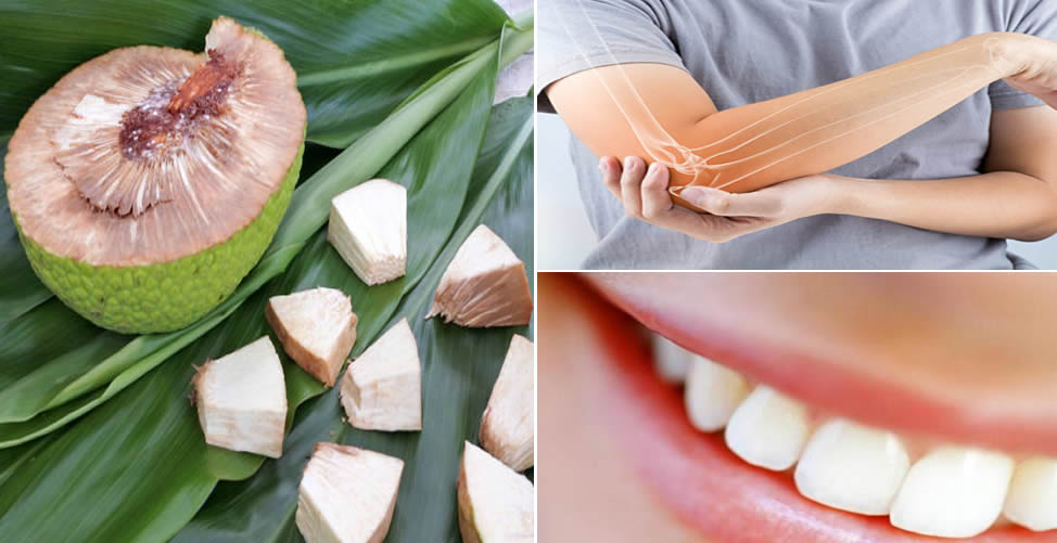Benefícios da Fruta Pão-Fortalece ossos e Dentes